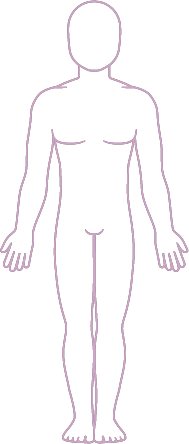 Common symptoms of RMS shown on the body.